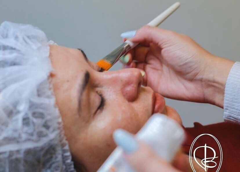 Revitalização facial