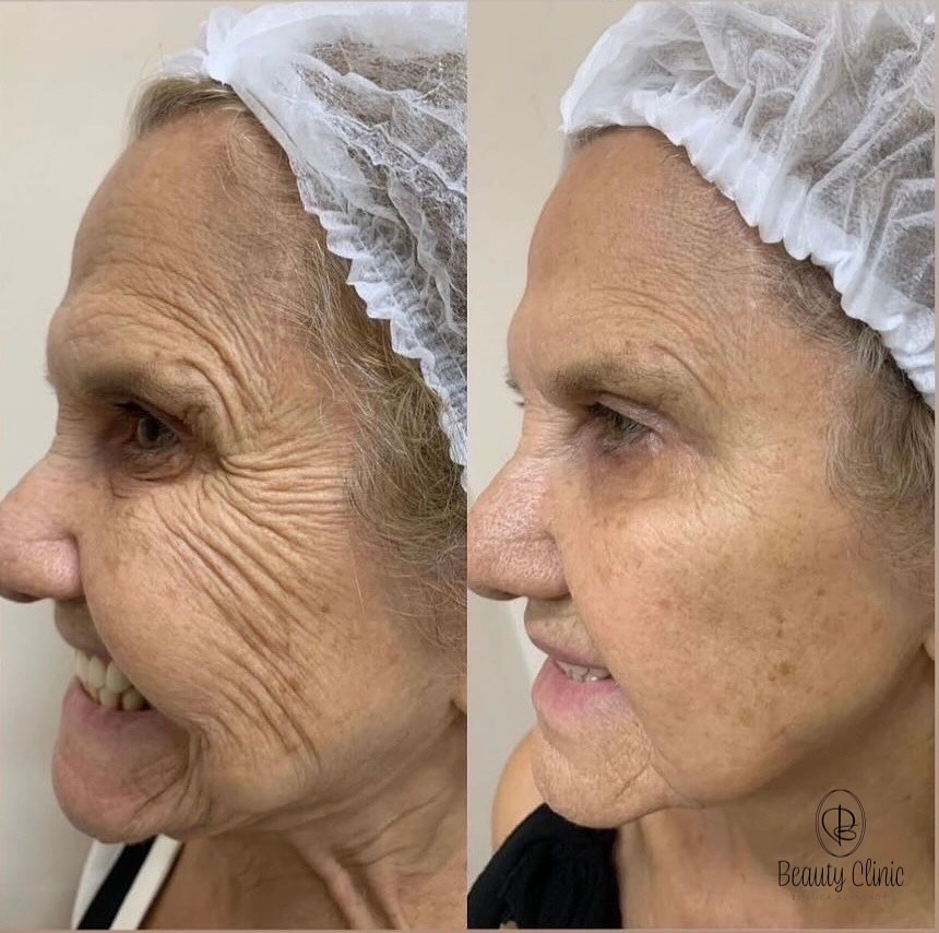 Clínica de Estética Avançada no Morumbi – Beauty Clinic