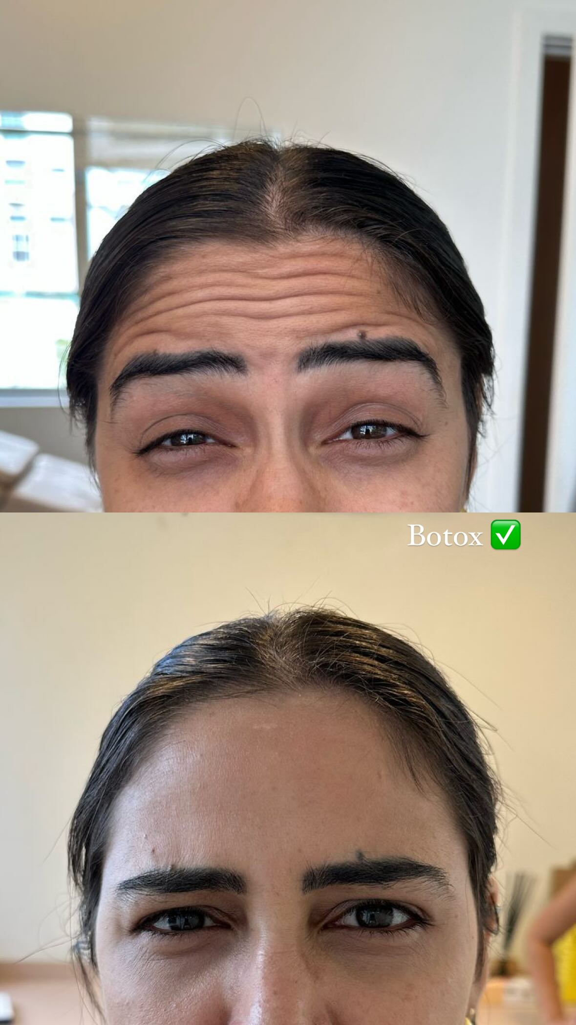 Botox e Preenchimento em Vila Andrade Morumbi | Beauty Clinic